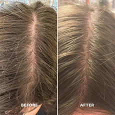 scalp duo before and after