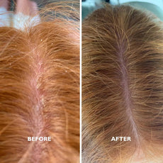 purifying scrub before and after